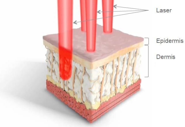 dermis-v2